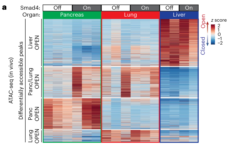 Chromatin States in Pancreatic Ductal Adenocarcinoma Control Metastatic Spread