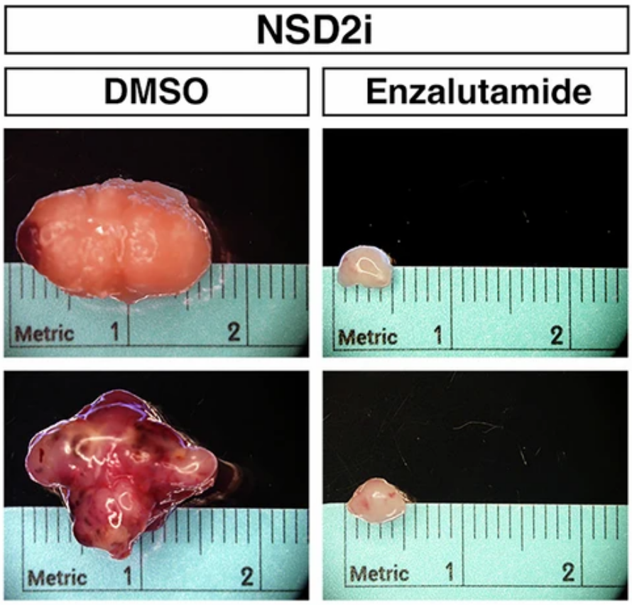 An Epigenetic Mechanism Behind Cancer Cell Plasticity